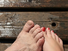 TOENAIL FUNGUS TREATMENT
