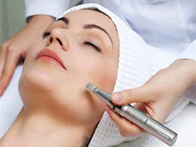 MICRONEEDLING